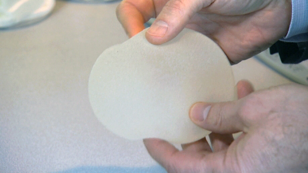 Biocell textured breast implants by Allergan