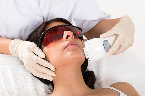 laser-facial-hair-removal