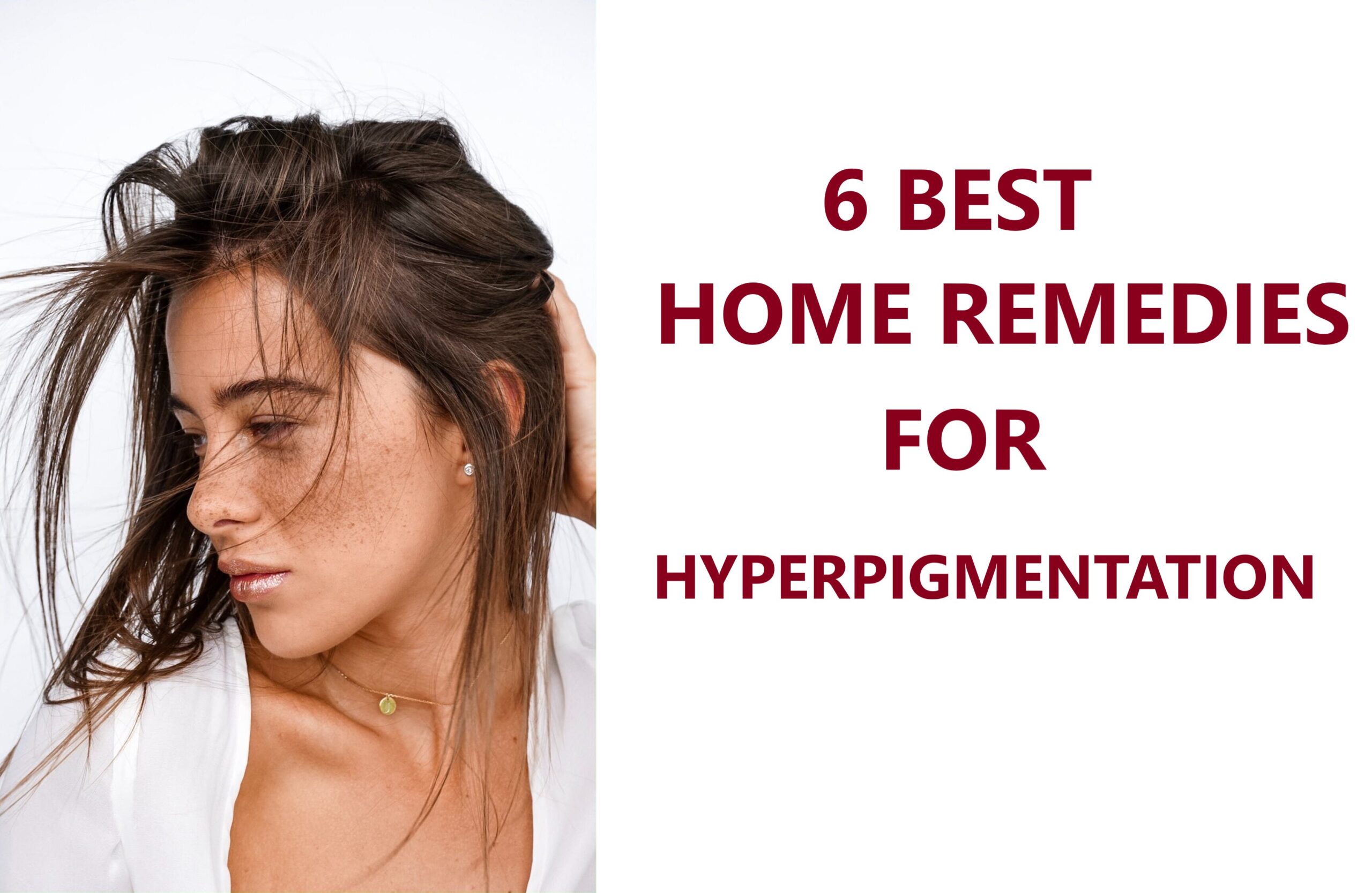 Home remedies for hyperpigmentation